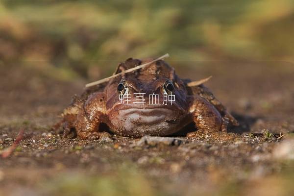 蛙耳血肿